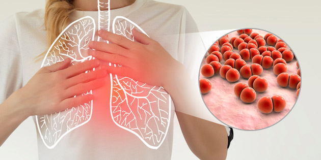 Dinkes Banyuwangi Koordinasi Fasilitas Kesehatan Hadapi Ancaman Pneumonia